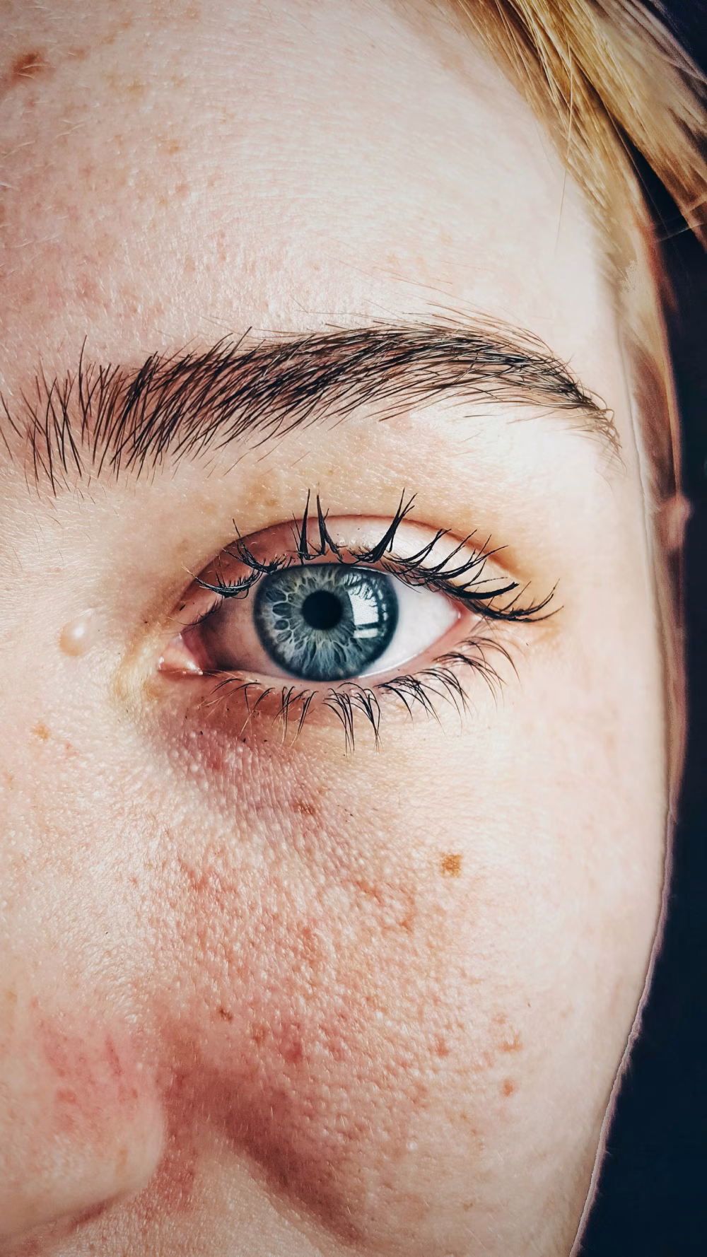 Close-Up of a Blue Eye with Detailed Skin Texture